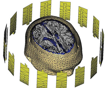 Microwave Imaging Systems